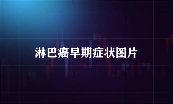 淋巴癌早期症状图片