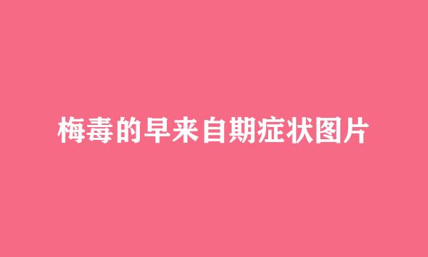 梅毒的早来自期症状图片