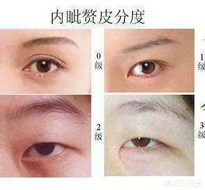 什么叫蒙古褶？