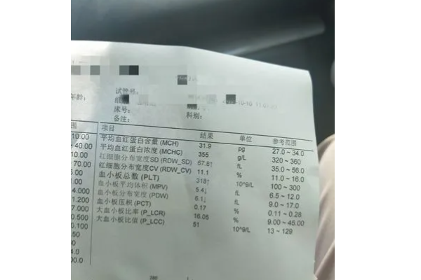 公务员体检不合格标准