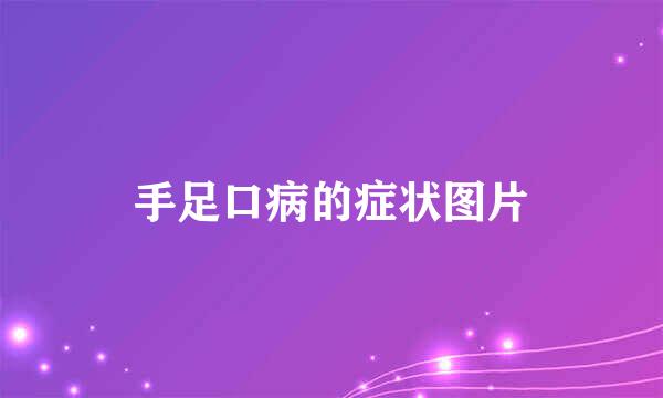 手足口病的症状图片